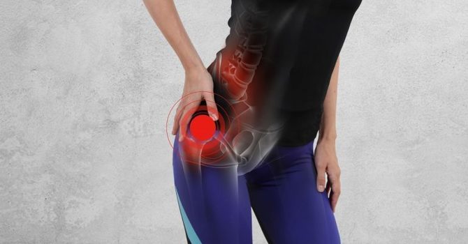 Gluteal Tendinopathy  image