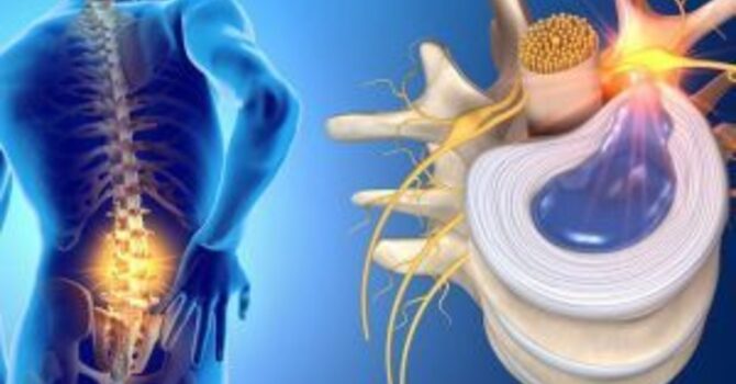 5 Reasons Why You Might Be Waking Up Sore. 